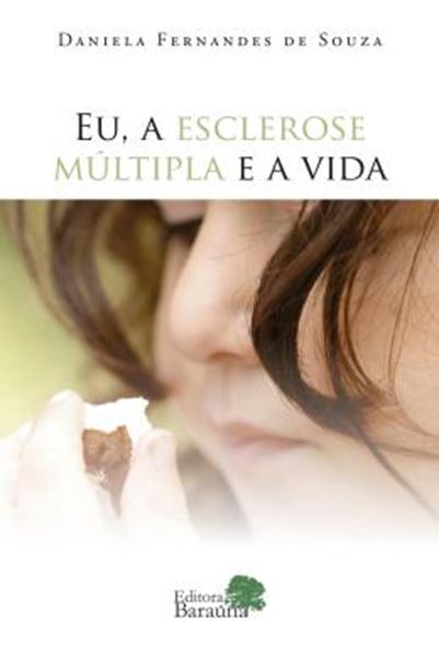 Picture of EU, A ESCLEROSE MULTIPLA E A VIDA