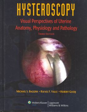 Imagem de HYSTEROSCOPY - VISUAL PERSPECTIVES OF UTERINE ANATOMY, PHYSIOLOGY AND PATHOLOGY - 3RD ED