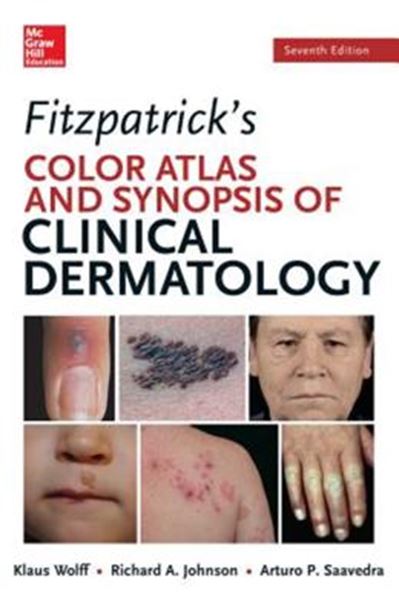 Picture of FITZPATRICKS COLOR ATLAS AND SYNOPSIS OF CLINICAL DERMATOLOGY - 7TH ED